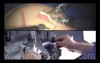 Da Vinci Robotic Surgery
