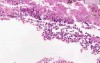 Lung (view 1) - bone (view 2) - liver (view 3)