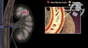 Nephropathy