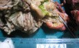 Synchronous Cancers, Familial Adenomatous Polyposis (31 of 36)