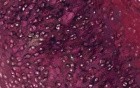 Elastic Cartilage - Histology
