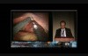 Single-Site Robotic Surgery: The Greek Experience