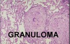 Infectious Diseases - MSP - 8j