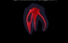 Mandibular Second Molar - Radix