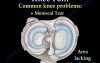 Common Causes of Knee Pain