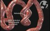Peristalsis and Nutirent Absorption in the Bowel