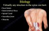 Low back Pain - causes and treatment methods
