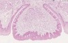 Tongue Circumvallate Papilla - Histology