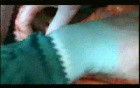 Open Right Hemicolectomy – Technical Principles - Operation No 1 - Part 3