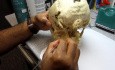 Dr.Insai.Ni Greater Palatine Part 2