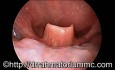 Larynx & Hypopharynx Examination