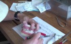 Ever Flame Your Niti Wires To Anneal Them?