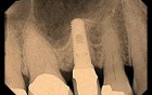 Transition In A Tight Spot