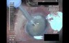 Cataract Surgery I - 1