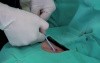 Catheter Insertion Through Subclavian Vein 