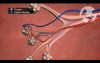 Normal Lung Anatomy and Function