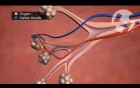 Normal Lung Anatomy and Function