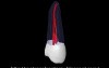 Maxillary Second Premolar