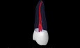 Maxillary Second Premolar