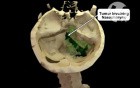 Volumated tumor