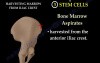 Stem Cells in Orthopaedics - Video Lecture