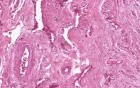 Penis - Histology