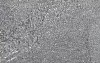 Lymph Node Reticulin Fibers - Histology