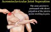 Shoulder Separation - Acromioclavicular Joint - Video Lecture
