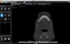 CBCT Viewing Software 101
