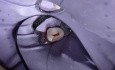 Post Endodontic Treatment #5 Comp Case #2
