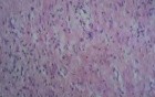 Cervical canal - Histopathological examination