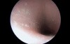 Urethral sphincter simulator