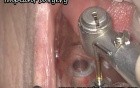 Value Of Microscopy In Dental Surgery
