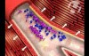 Platelet Aggregation