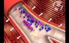 Platelet Aggregation