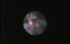 Retrograde Intrarenal Surgery