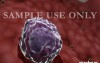 Oxidation Of Low Density Lipoproteins (LDL)