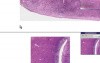 Endometrium - Senile Atrophy