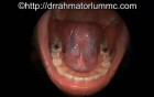 The Human Floor of Mouth and The Tongue Anatomy