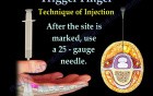 Trigger Finger  - Video Lecture