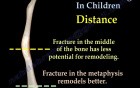 Bone healing and remodeling in children - Video Lecture