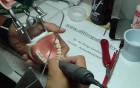 Anterior Bridge Preparation, Part 10 - Jet Provisional Restoration - Finishing Margins Intraorally