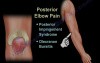 Common Causes of Elbow Pain - Video Lecture