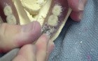 Dental Lab Outtakes - Tooth On The Move - Part 1/2 : Denture Repair