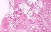 Rectum (15 of 30)