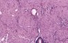 Gall Bladder - Histology