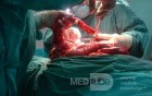 Mesenteric Ischemia (10 of 12)