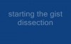 Resection of GI stromal tumor