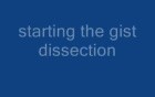 Resection of GI stromal tumor