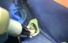Periodontal Splinting